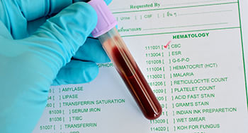 Interpretacao-de-Hemograma