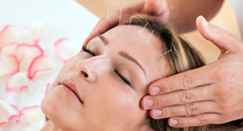 Acupuntura-Estetica